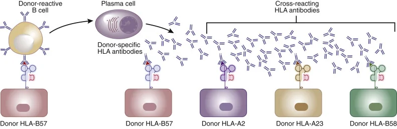 HLA Typing for Transplant